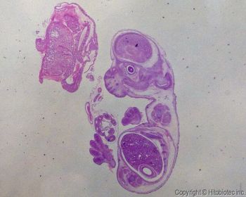 Mouse embryo sections (15-19 days)